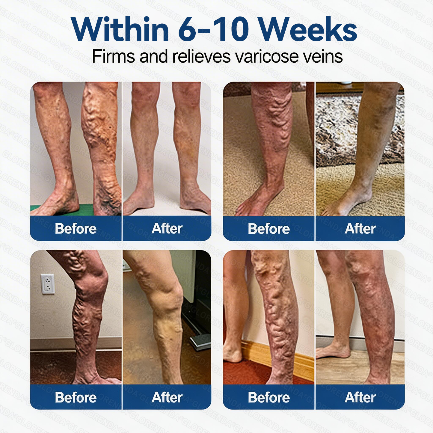 𝐆𝑳𝑶𝗥𝙀𝙉𝐃𝑨® 𝑽𝗲𝗶𝙣 𝘾𝐨𝐧𝘁𝗼𝙪𝙧 𝙈𝙞𝐜𝐫𝒐𝒏𝒆𝗲𝗱𝗹𝙚 𝙋𝙖𝐭𝐜𝒉